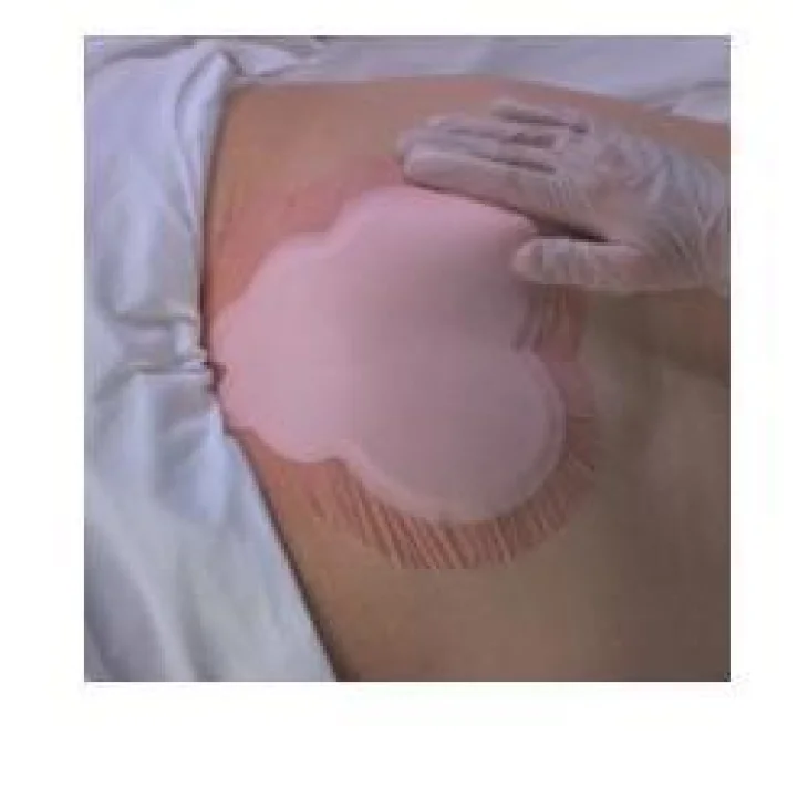 ALLEVYN SACRUM 22,5X22,1 10MED ALLEVYN SACRUM 22,5X22,1 10MED