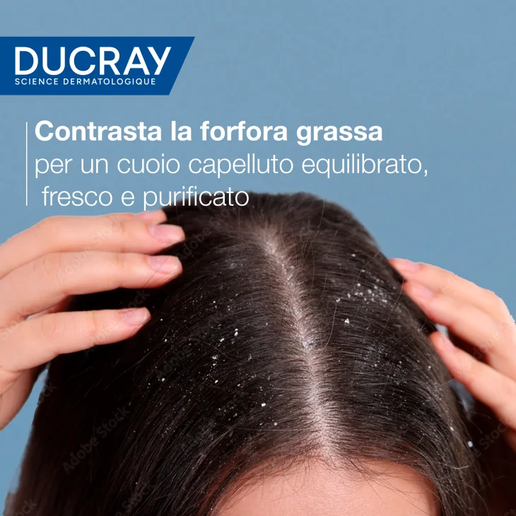 Ducray Kelual Squanorm Shampoo Antiforfora Grassa 200 ml
