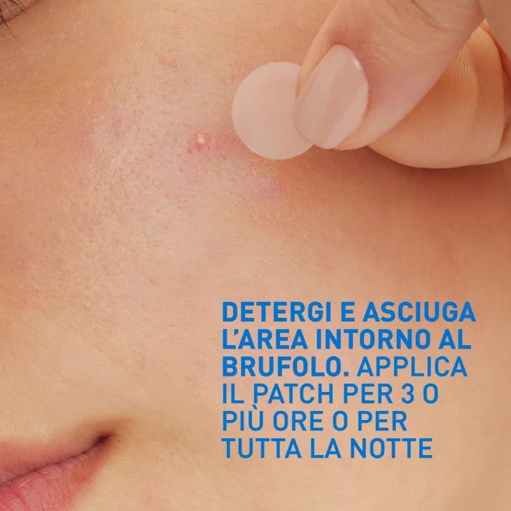 CeraVe Patches Idrocolloidali Anti Brufoli Per Pelli a Tendenza Acneica Trasparenti e Invisibili sulla Pelle 22 pezzi