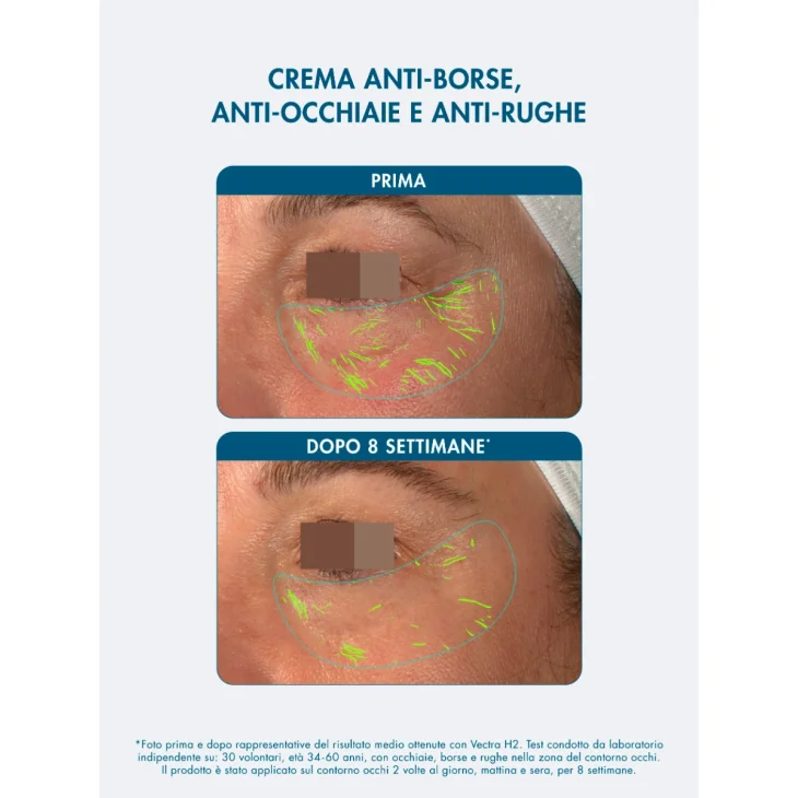 Miamo Supreme Anti Fatigue Eye Cream Crema Contorno Occhi Anti-borse e Occhiaie 15 ml Miamo Supreme Anti Fatigue Eye Cream Crema Contorno Occhi Anti-borse e Occhiaie 15 ml