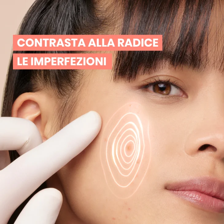 Av&egrave;ne Eau Thermale Av&egrave;ne Cleanance Comedomed+ Trattamento Intensivo Quotidiano Anti-Imperfezioni 30ml