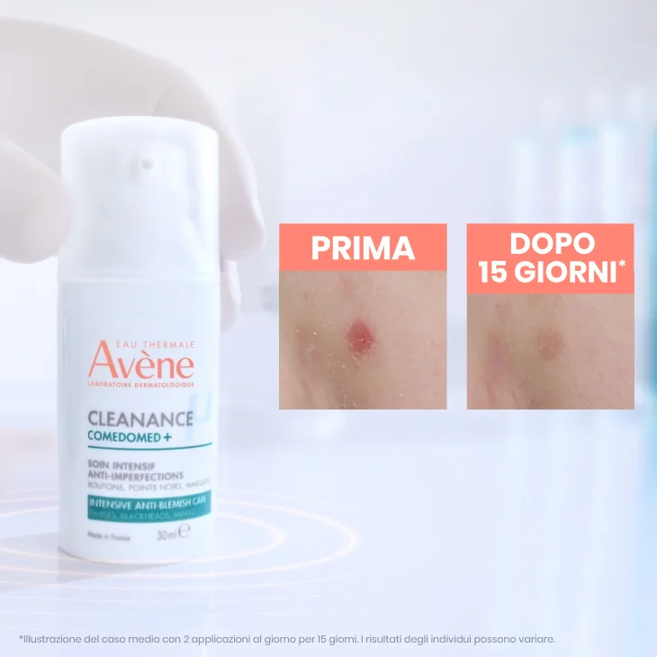 Av&egrave;ne Eau Thermale Av&egrave;ne Cleanance Comedomed+ Trattamento Intensivo Quotidiano Anti-Imperfezioni 30ml