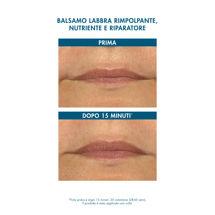 Miamo Longevity Plus Hyalu Repair Lip Balm Balsamo Labbra Riparatore Aroma Frutti Tropicali 15 ml
