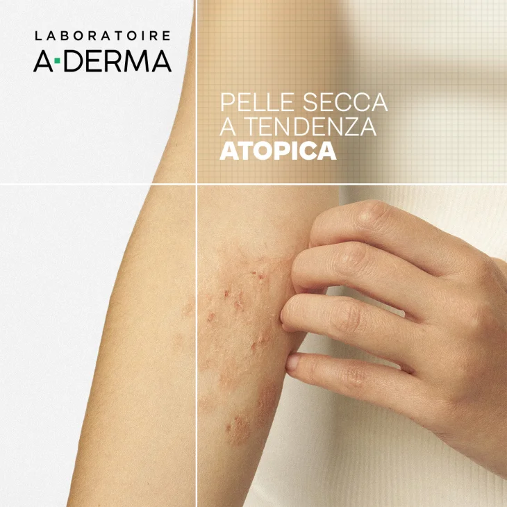 A-Derma Exomega Control Olio Detergente Emolliente “anti-grattage”, Nutriente Lenitivo, Pelle secca a tendenza atopica, viso e corpo di tutta la famiglia, 1l A-Derma Exomega Control Olio Detergente Emolliente “anti-grattage”, Nutriente Lenitivo, Pelle secca a tendenza atopica, viso e corpo di tutta la famiglia, 1l