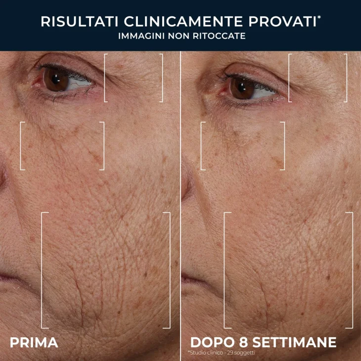 Roc Line Smoothing Retinol Correxion Triple Serum siero viso tripla azione 30 ml