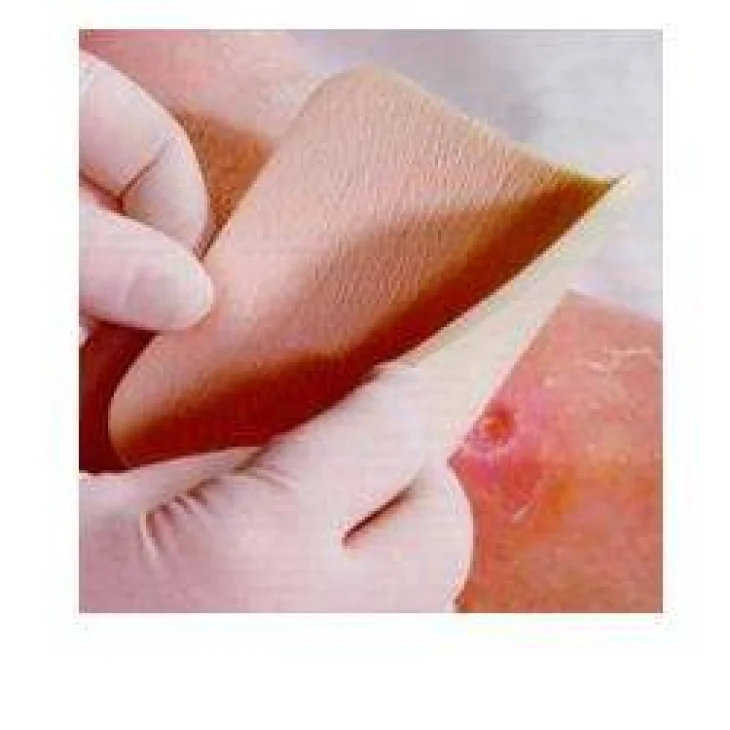 Allevyn Non Adhesive Medicazione idrocellulare e sterile 10x10 cm 3 Pezzi Allevyn Non Adhesive Medicazione idrocellulare e sterile 10x10 cm 3 Pezzi