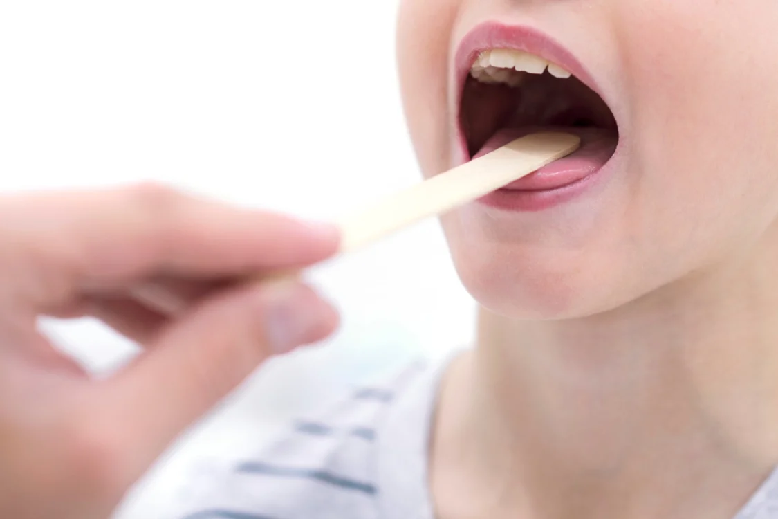 Streptococco: quali sono i sintomi e come si cura? 