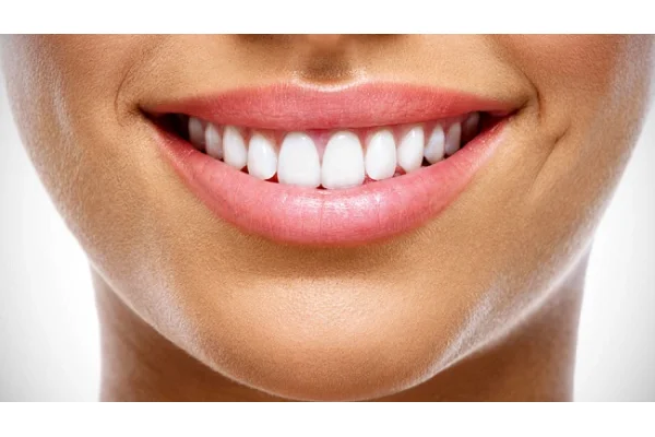 Come mantenere i denti bianchi