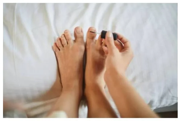 Come trattare la micosi delle unghie: scopriamolo qui!