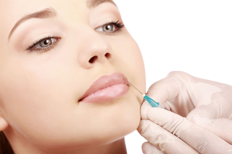 I filler riempiono i volumi del viso