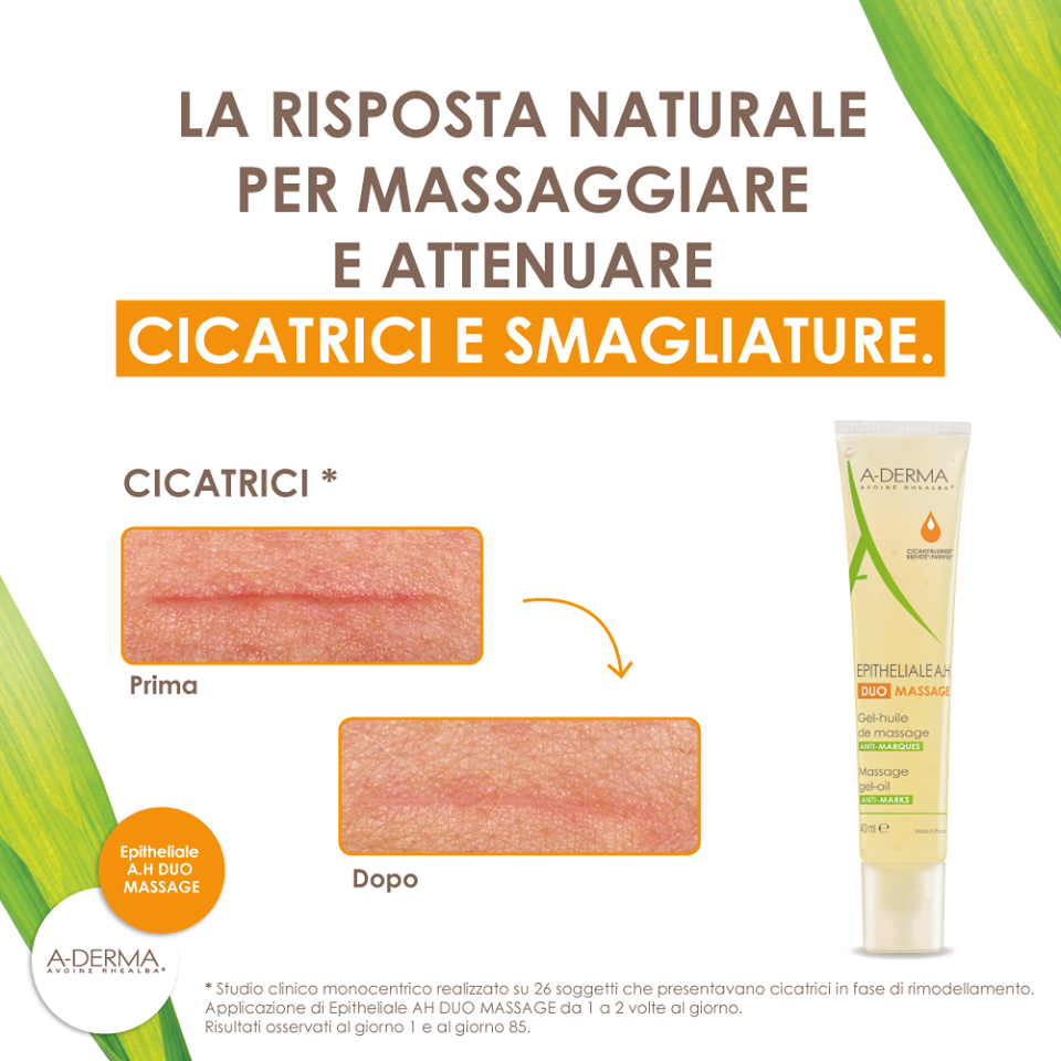 smagliature